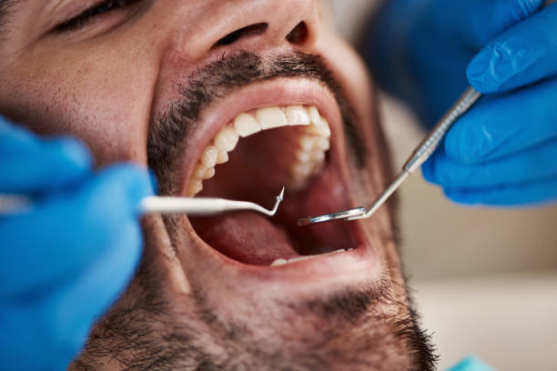 Best Emergency Gum Treatment in Blue Mound, TX