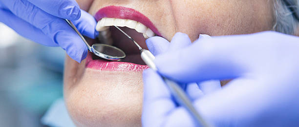 Best Emergency Wisdom Teeth Removal in Blue Mound, TX