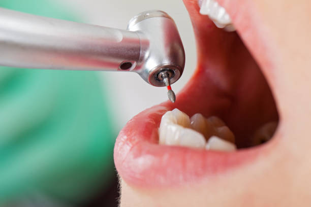 Best Emergency Dental Care for Broken or Chipped Teeth in Blue Mound, TX